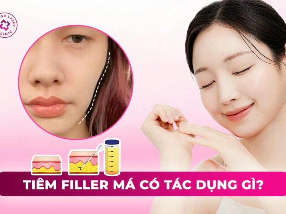 Tiêu chí chọn clinic và bác sĩ — hồ sơ sản phẩm, hyaluronidase và quy trình xử trí