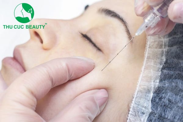 Làm sao để chọn nơi tiêm filler an toàn, chất lượng và tránh rủi ro?