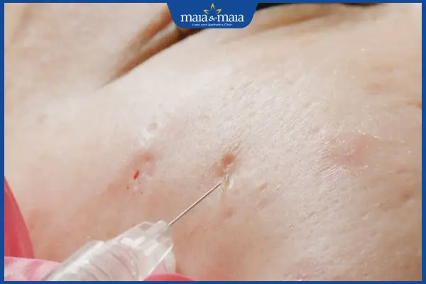 Sau điều trị: chăm sóc, theo dõi và lịch tái điều trị