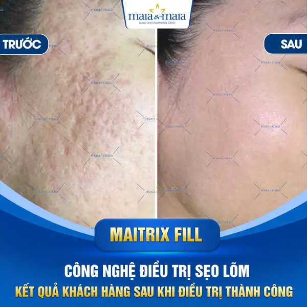 Lựa chọn cơ sở và tiêu chí an toàn khi quyết định điều trị