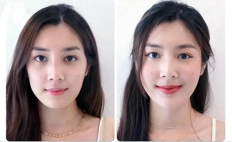 Tiêu chí chọn cơ sở và bác sĩ tiêm filler tại HCM, Hà Nội, Cần Thơ