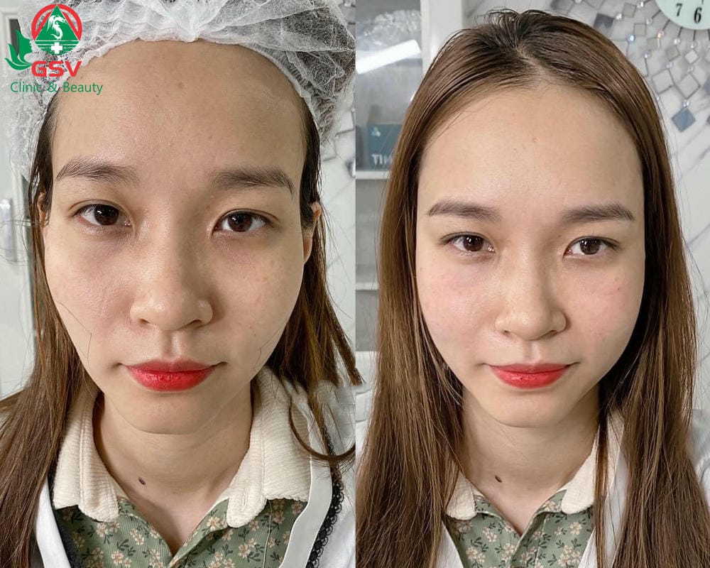 Những câu hỏi thường gặp