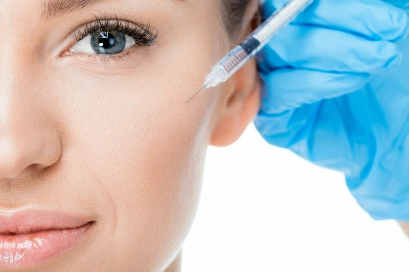 Tiêm filler hay ghép mỡ tự thân / nâng má bằng chỉ — phương án nào an toàn và bền hơn?