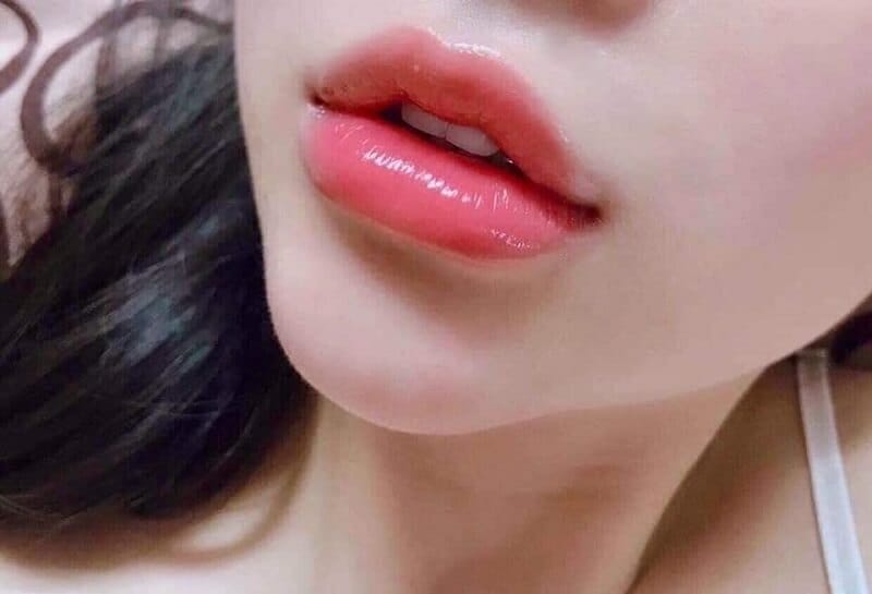 Lợi ích và so sánh: Tiêm môi baby khác gì so với các dáng môi khác?