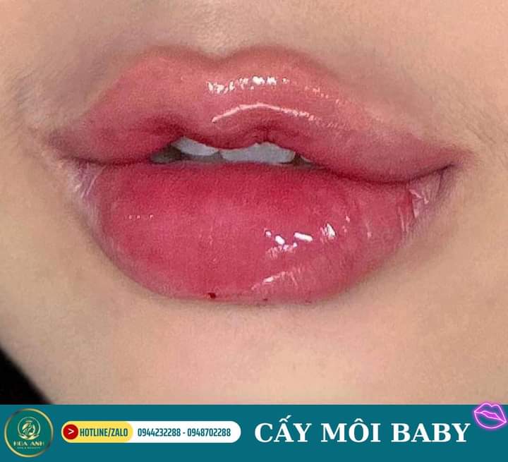 Bạn sẽ trả bao nhiêu và tiêu chí lựa chọn theo chi phí?