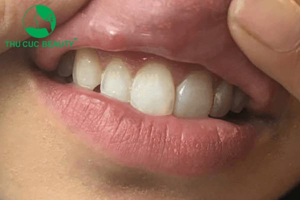 Bằng chứng y học và kinh nghiệm chuyên môn: điều gì hỗ trợ quyết định điều trị?