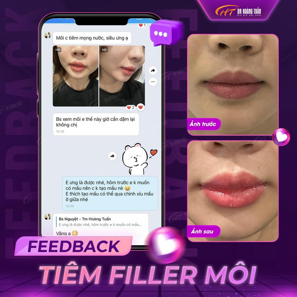 Làm sao để nhận biết một cơ sở tiêm filler môi đủ tiêu chuẩn?