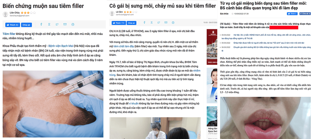 Ai không phù hợp tiêm filler môi, cần thận trọng đặc biệt?