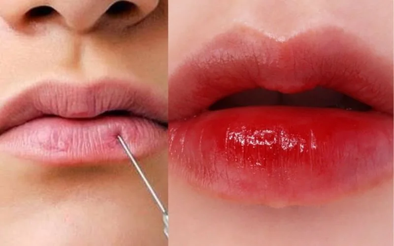 Các bằng chứng lâm sàng và thông tin cần biết về rủi ro