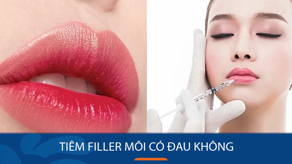 Bằng chứng lâm sàng: có nghiên cứu nào nói rõ về mức độ đau và cách quản lý?