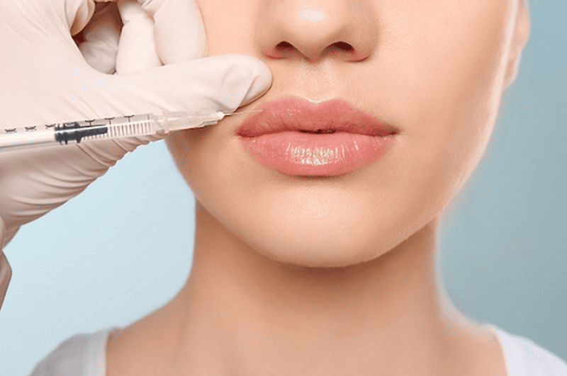 Cơ chế: vì sao mát-xa, nhiệt và cử động mạnh ảnh hưởng tới filler?