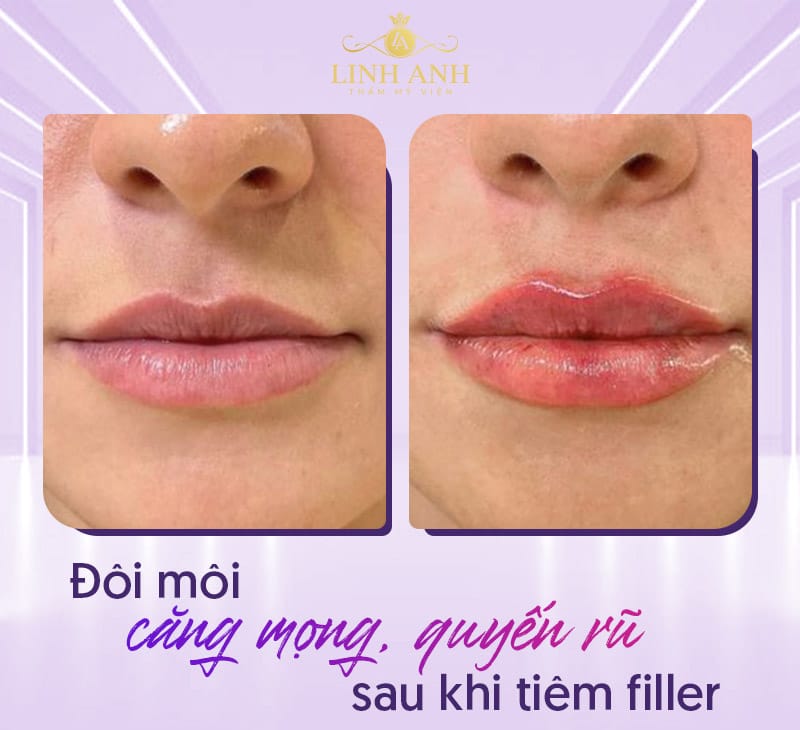Chế độ ăn uống và thói quen hàng ngày: có cần kiêng hải sản, gà, hay đồ nếp?