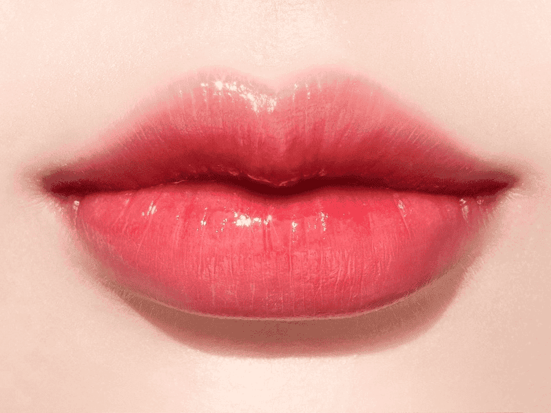 Tác dụng phụ và biến chứng tiêm filler môi — khi nào cần lo lắng?