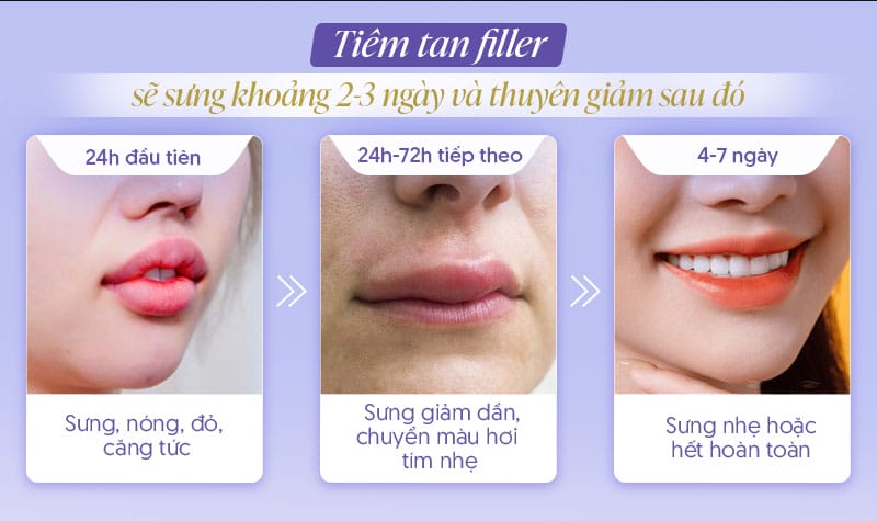 Sưng do filler khác với sưng do dị ứng hay nhiễm trùng như thế nào?