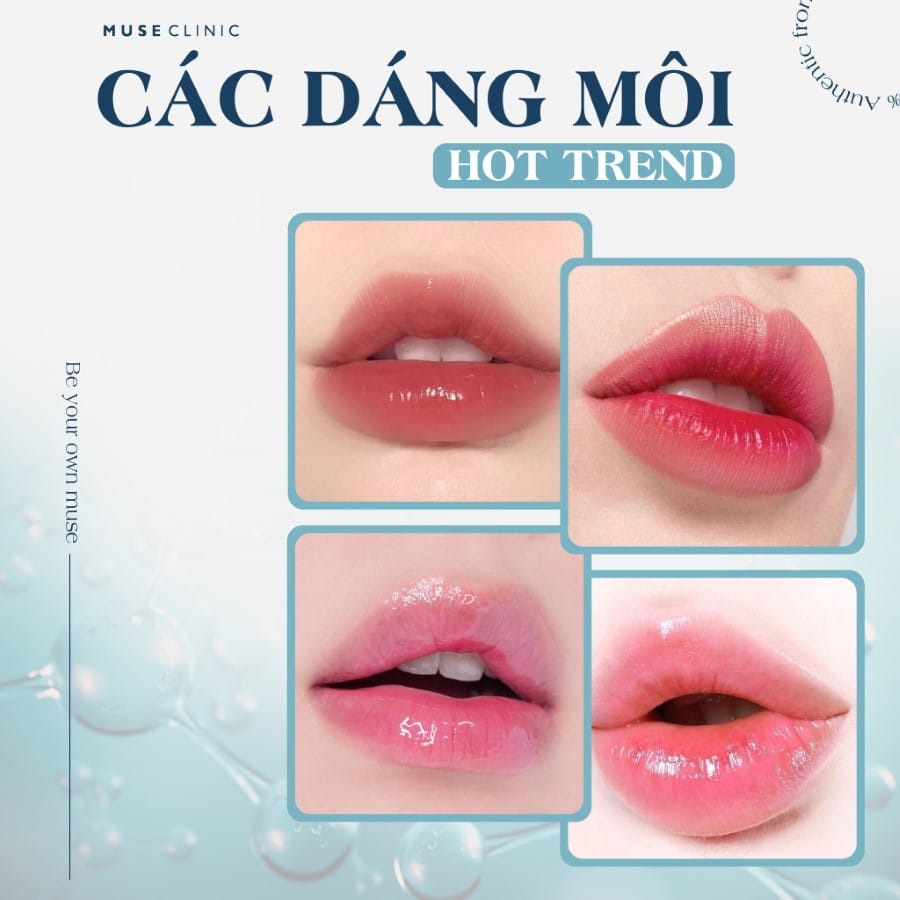Quy trình tiêm filler môi trái tim an toàn — từng bước bạn nên biết?