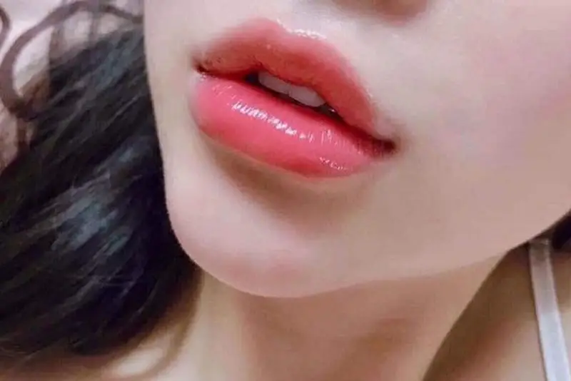 Quy trình phát hiện và xử trí biến chứng nặng như tắc mạch (các bước cần biết)