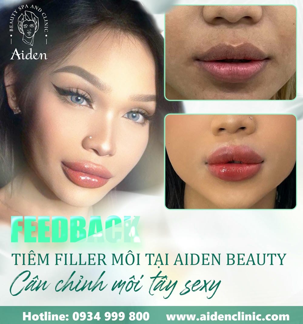 Hướng dẫn chăm sóc cơ bản sau tiêm