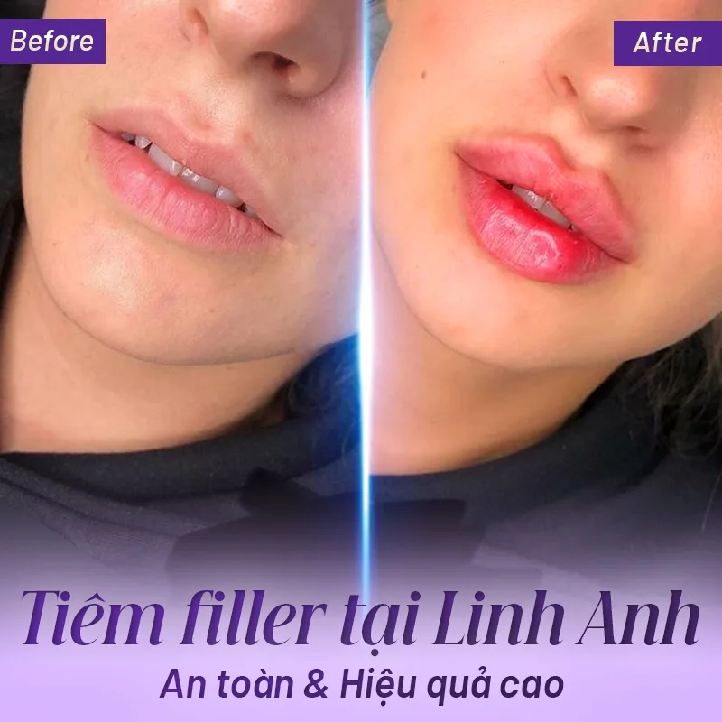 Những biến chứng cần biết — khi nào phải đến ngay cơ sở y tế?