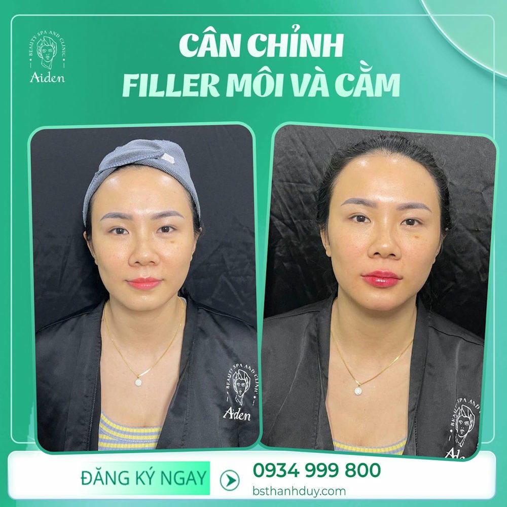 Các câu hỏi thường gặp mà khách hàng hay tự hỏi
