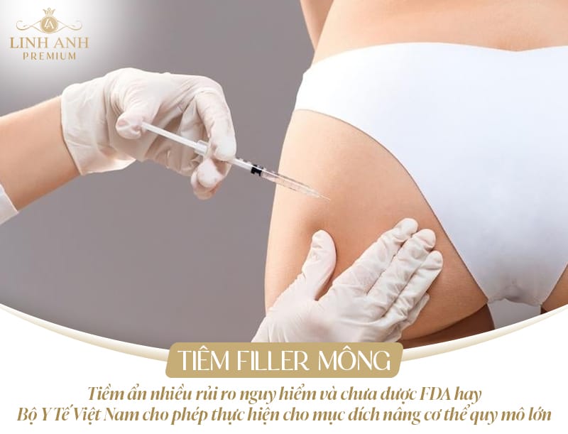 Tôi nên so sánh tiêm filler mông với các lựa chọn thay thế nào?