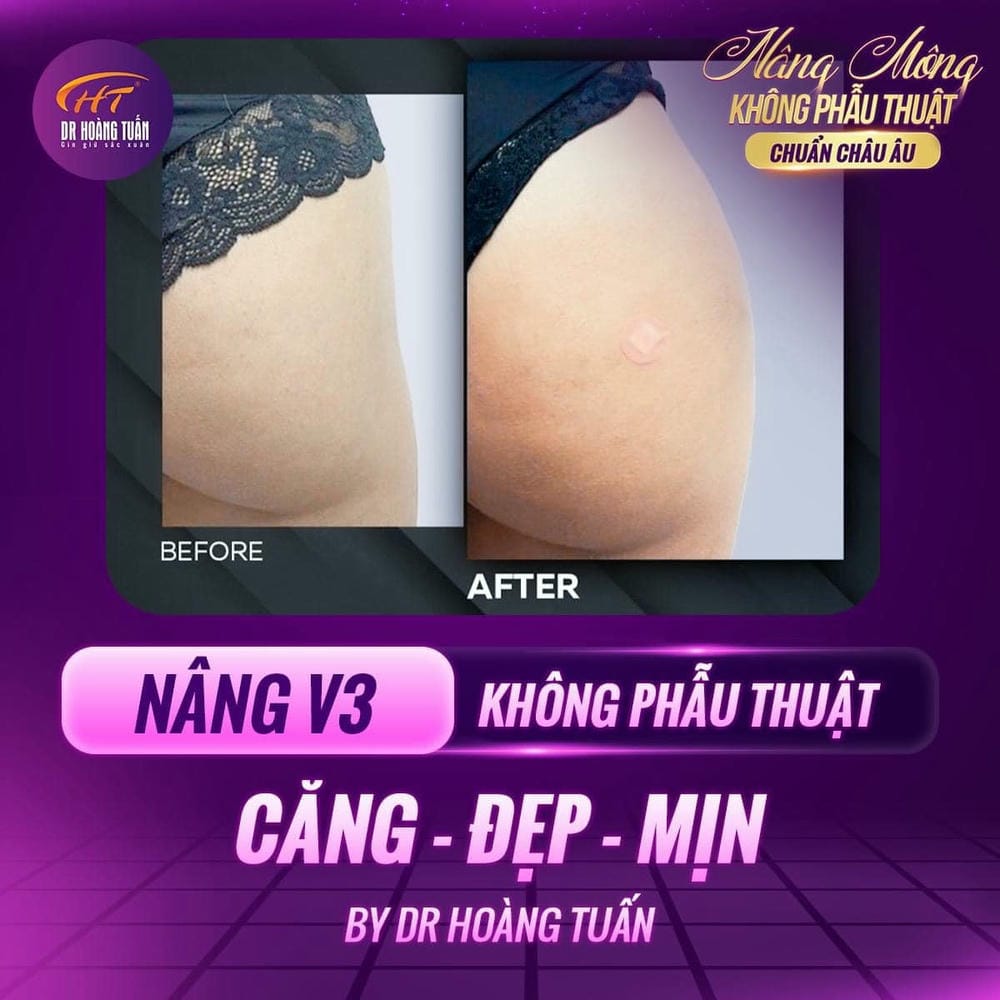 Nếu vẫn cân nhắc làm — quy trình an toàn tối thiểu cần có (theo trình tự)