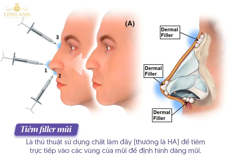 Chăm sóc sau tiêm và những dấu hiệu cần đến khám ngay?