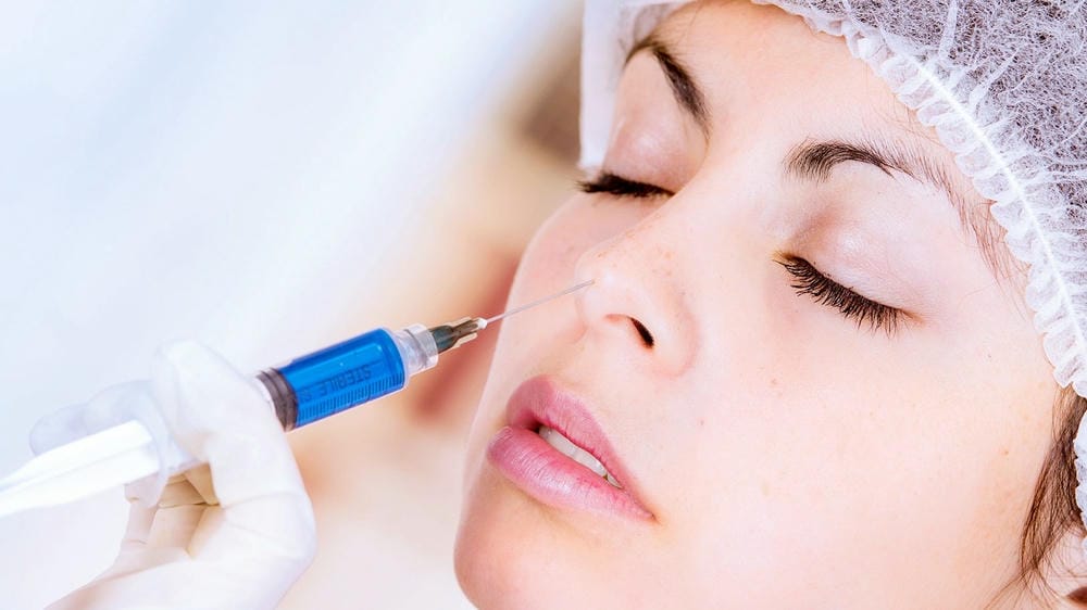 Bao lâu sau khi tiêm filler mũi có thể phẫu thuật nâng mũi hoặc can thiệp khác?