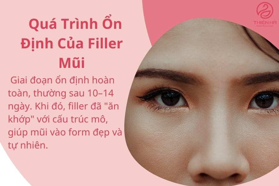 Khi nào nên dặm, khi nào nên chờ — nguyên tắc an toàn để tránh chỉnh sửa vội vàng (dặm filler mũi)