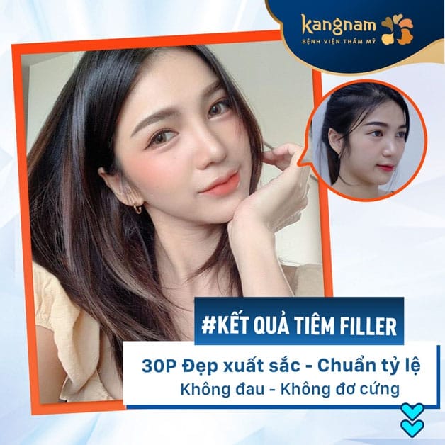 Mình có thể đeo kính (gọng) ngay sau khi tiêm không?