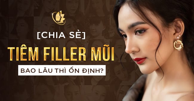 Tiêm filler mũi rồi có cần nghỉ làm không?