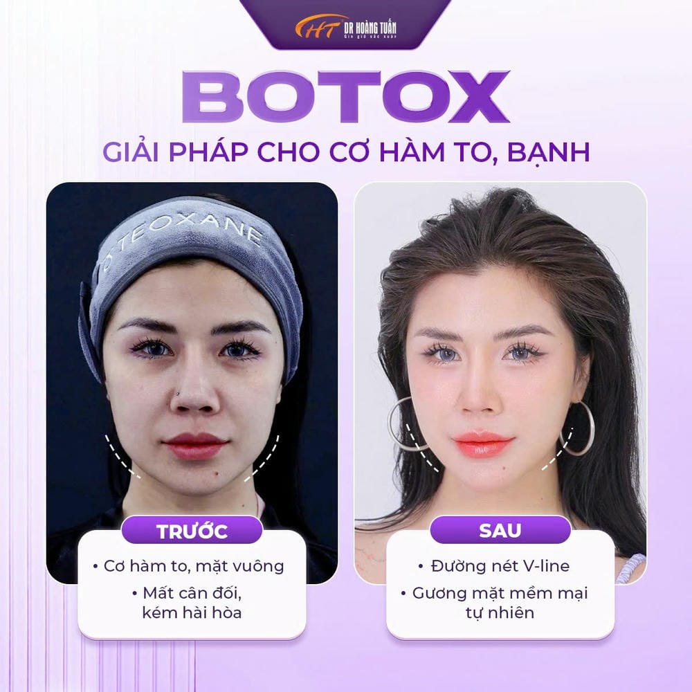 Những ai phù hợp / không phù hợp với mỗi phương pháp?