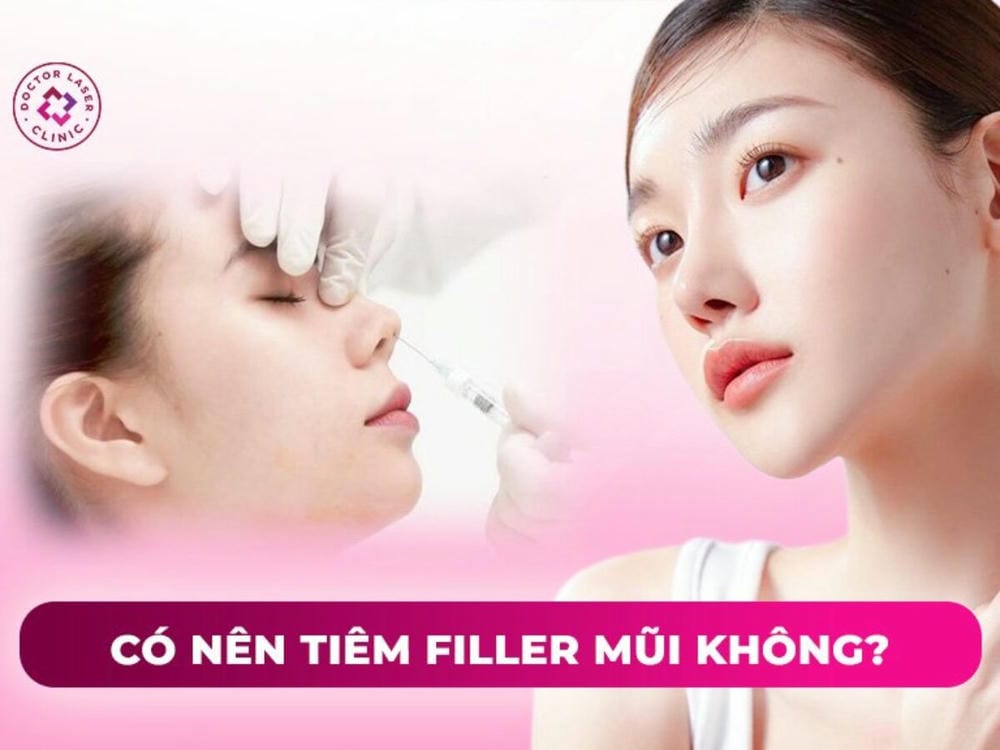 Thời gian hiệu quả và khi nào nên tan filler?