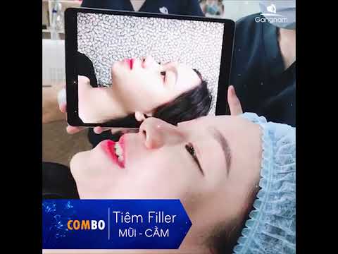 Ai là người phù hợp và ai nên tránh tiêm filler mũi?