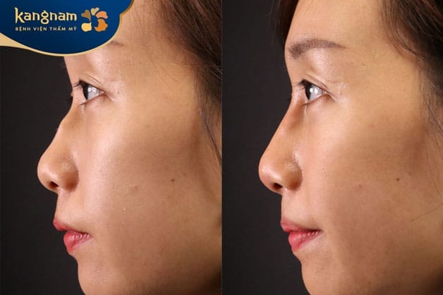 Điều cần biết về giấy phép và nguồn gốc
