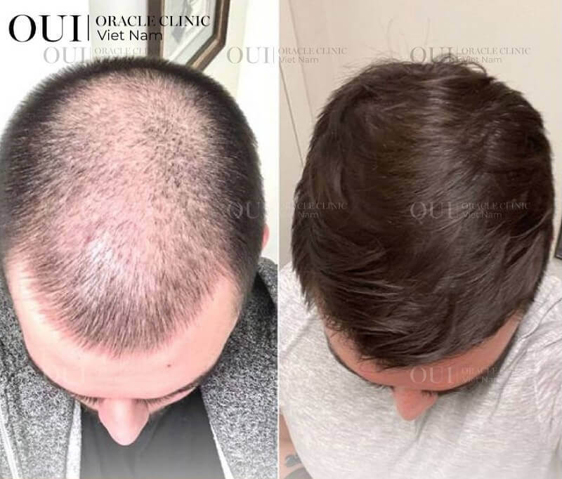 Khi nào nên chọn phương pháp thay thế hoặc chuyển hướng điều trị?