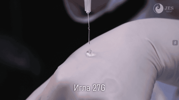 Ai không nên tiêm filler ngực — chống chỉ định thường gặp?