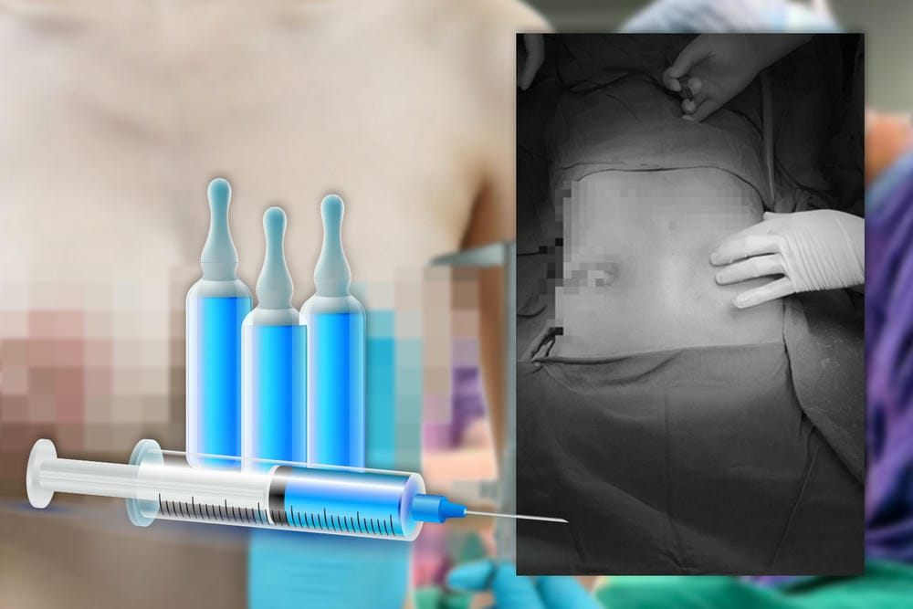 Quy trình khám, thủ thuật và chăm sóc sau tiêm như thế nào?