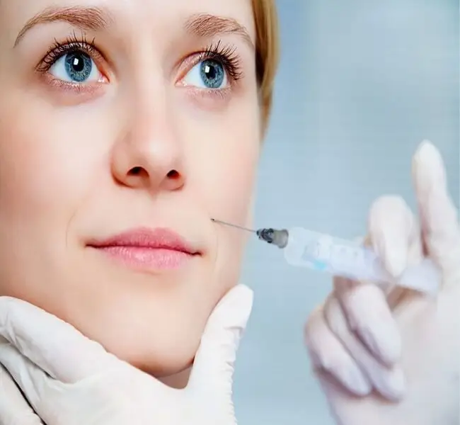 Câu hỏi thường gặp về thời gian hồi phục filler rãnh cười