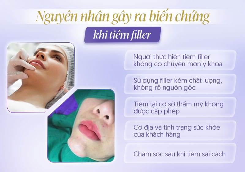 Các biện pháp điều trị chuyên sâu — xử trí biến chứng filler bằng hyaluronidase, steroid, kháng sinh