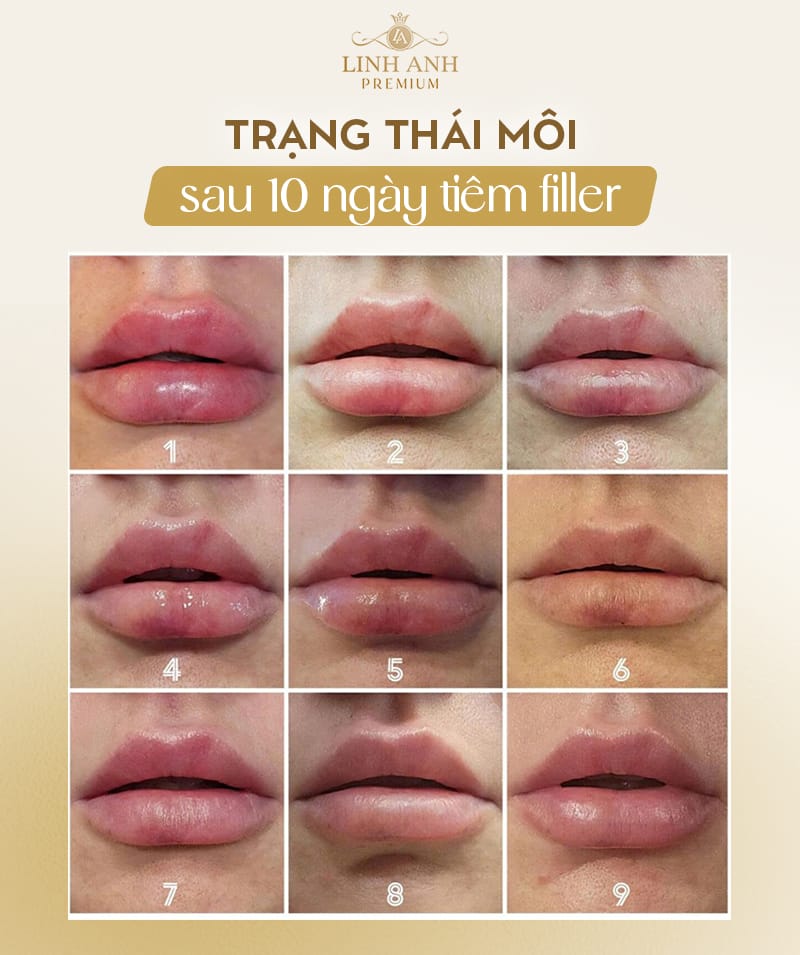Khi nào cần đến gặp bác sĩ — dấu hiệu cảnh báo biến chứng