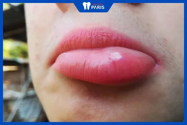 Các câu hỏi thực tế patients thường hỏi — và câu trả lời thẳng thắn
