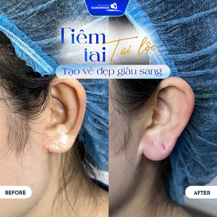 Các tác dụng phụ thường gặp và cách xử trí cơ bản