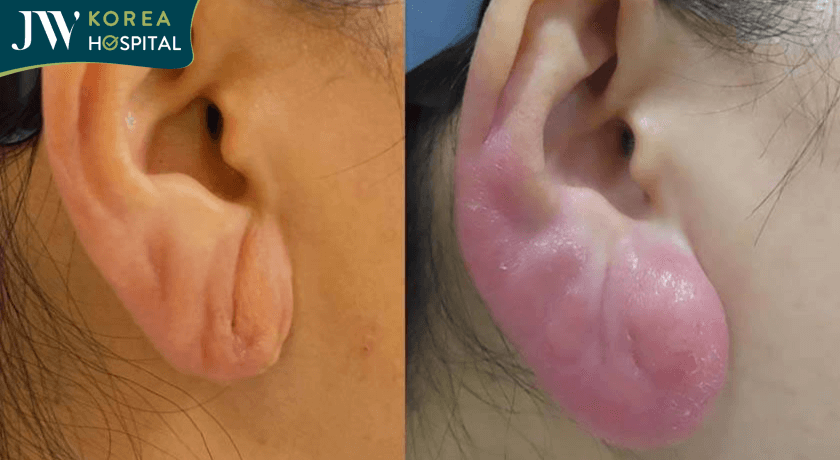 Thời gian duy trì