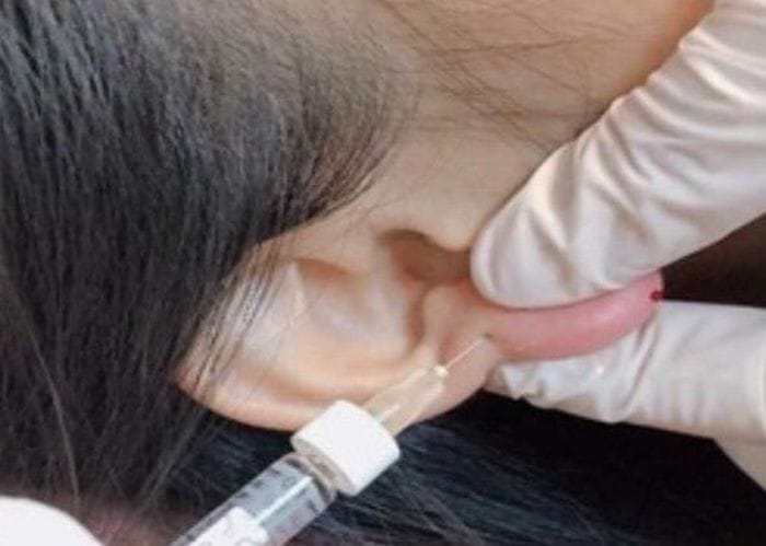 Chi phí tại TP.HCM, Hà Nội, Cần Thơ — nên hiểu giá thế nào?