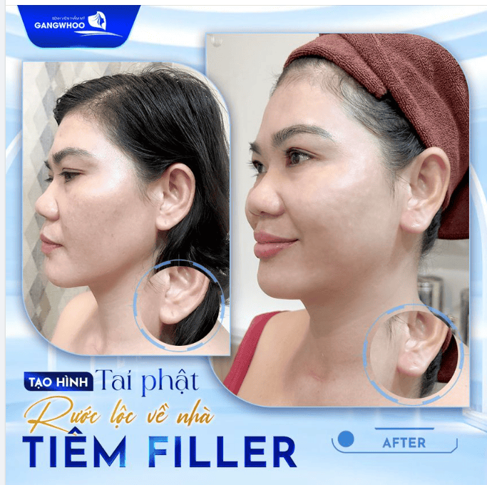Khi nào cần gặp bác sĩ gấp sau tiêm?