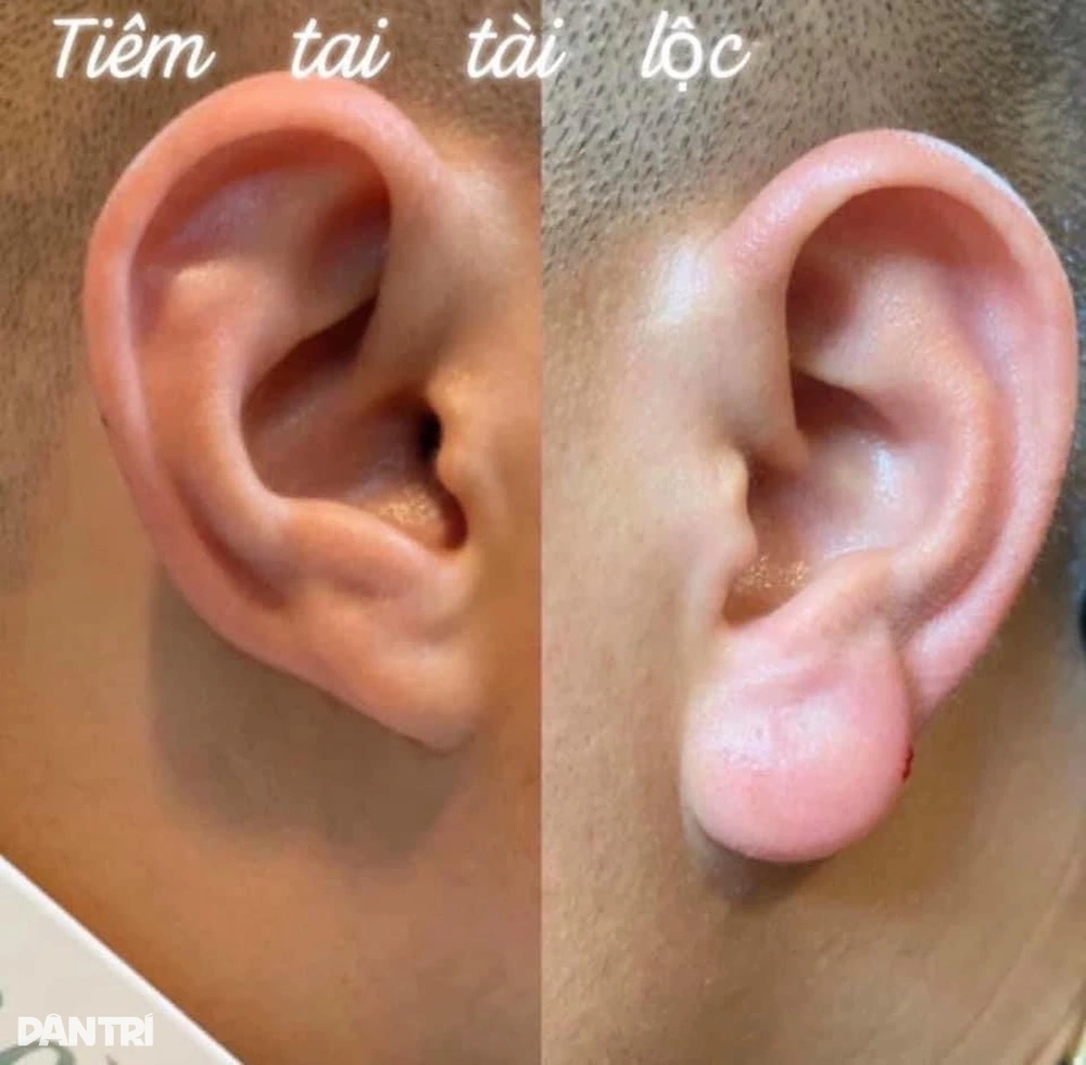Tại sao nên ưu tiên Vivacy, Opera, Aileene?