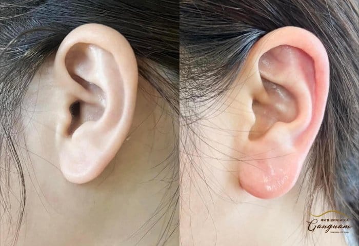 Lưu ý pháp lý và tiêu chuẩn sản phẩm tại Việt Nam