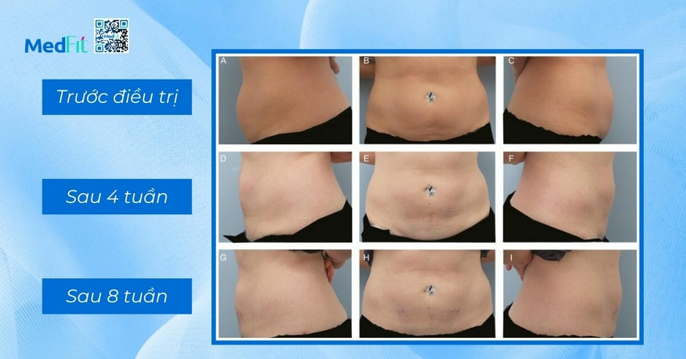 Chăm sóc sau thủ thuật và dấu hiệu cần liên hệ ngay với bác sĩ