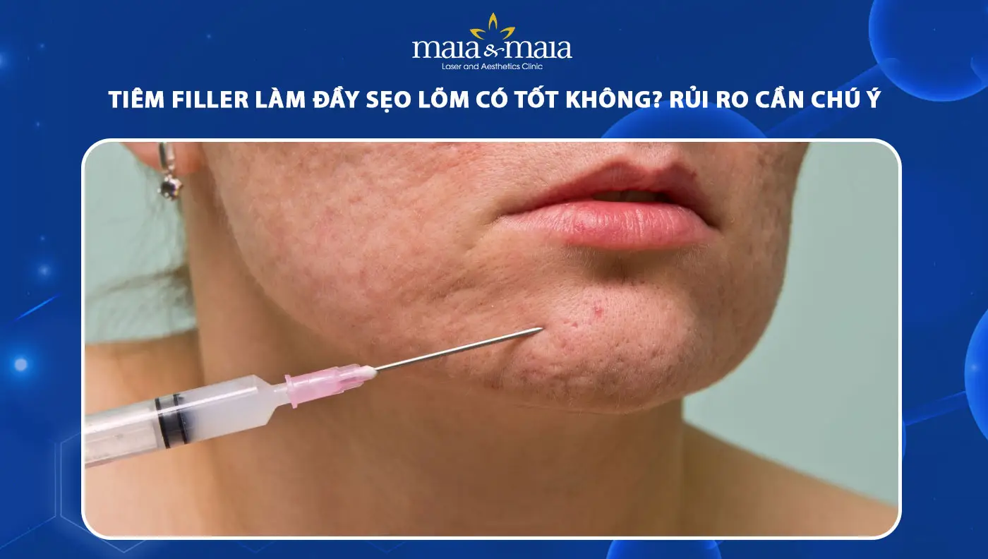Hiệu quả kéo dài bao lâu — cần bao nhiêu lần điều trị?