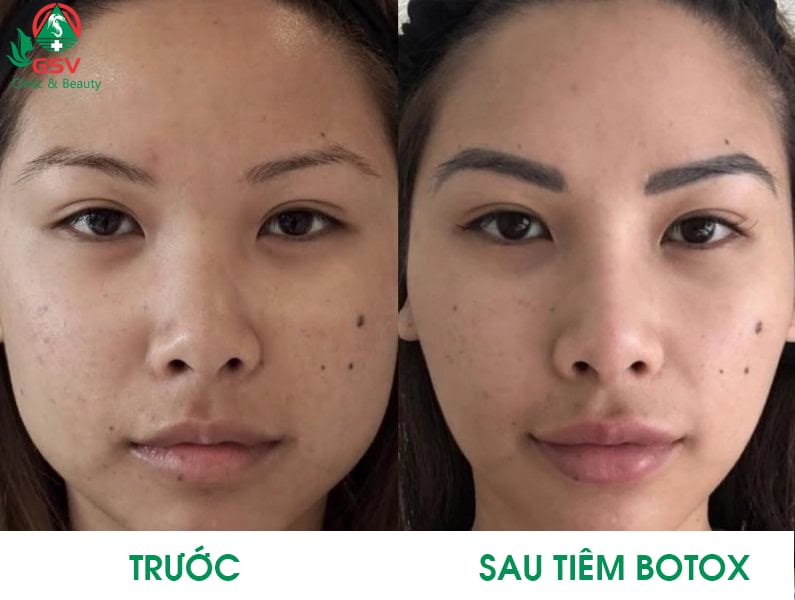 Câu hỏi thường gặp